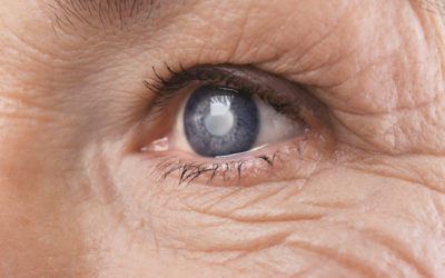 4 Age Related Eye Problems You Should Know About
